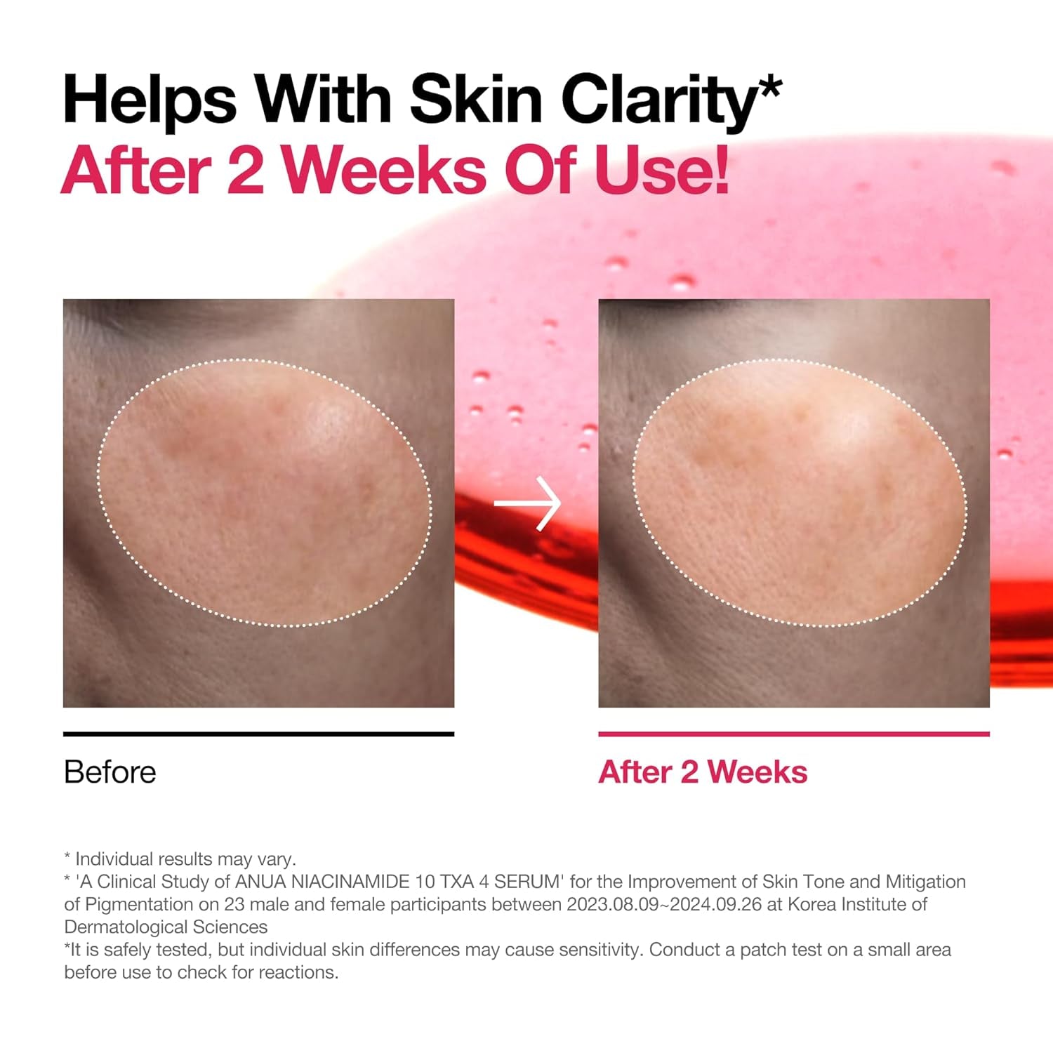 Niacinamide 10 + TXA 4 Serum, Hyaluronic Acid, Tranexamic Acid, Facial Serum for Glassskin, Glow Back Serum, Dark Spot Care, Postnatal Skincare, Korean Skincare (30Ml/1.01 Fl.Oz)